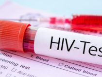 Test dell’HIV: Militare obbligato a dare il proprio consenso