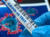 Covid: Omicron 5, che cos’è il tampone COI
