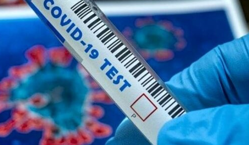 Covid: Omicron 5, che cos’è il tampone COI